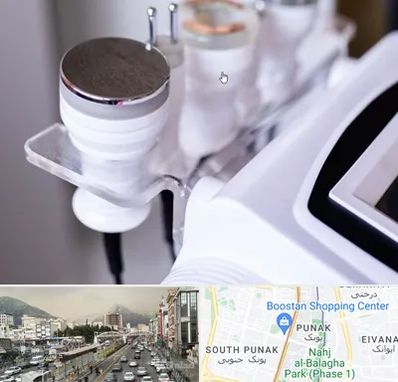 مرکز لاغری با کویتیشن در پونک 