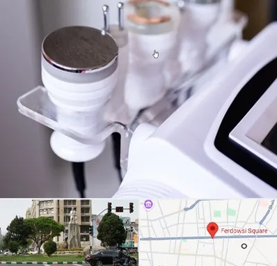 مرکز لاغری با کویتیشن در میدان فردوسی تهران