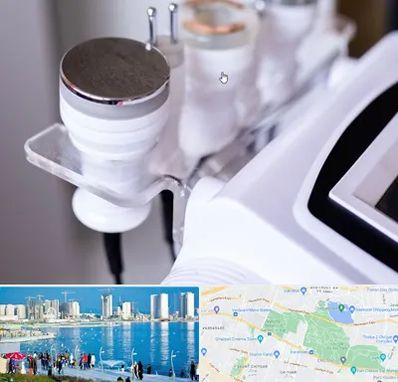 مرکز لاغری با کویتیشن در چیتگر 