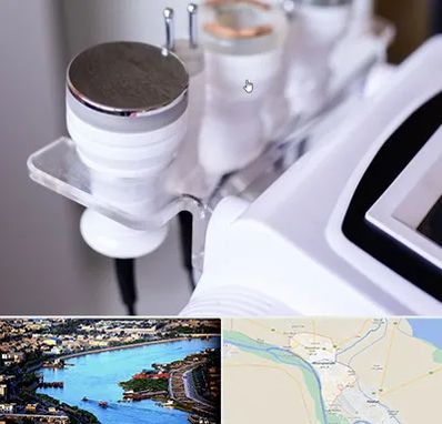 مرکز لاغری با کویتیشن در خرمشهر