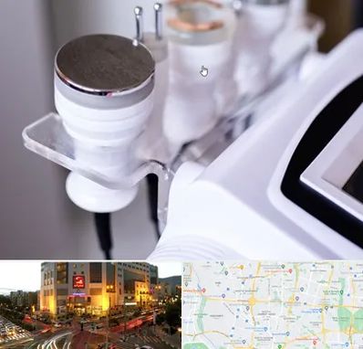 مرکز لاغری با کویتیشن در جنت آباد تهران 