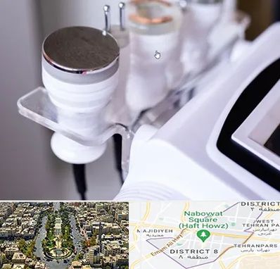 مرکز لاغری با کویتیشن در نارمک 