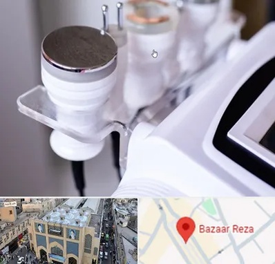 مرکز لاغری با کویتیشن در بازار رضا مشهد