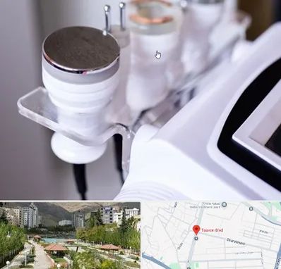 مرکز لاغری با کویتیشن در بلوار تعاون