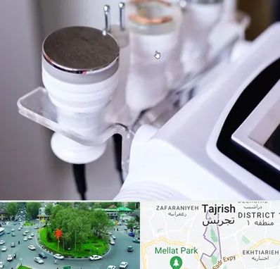 مرکز لاغری با کویتیشن در تجریش 