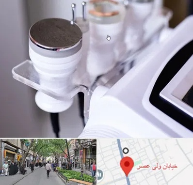 مرکز لاغری با کویتیشن در ولیعصر شهریار