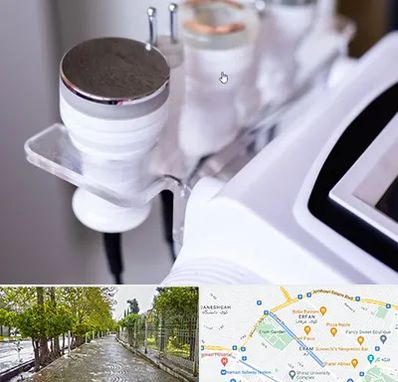 مرکز لاغری با کویتیشن در خیابان ارم شیراز 