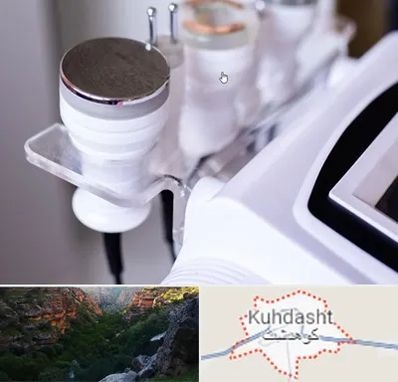 مرکز لاغری با کویتیشن در کوهدشت