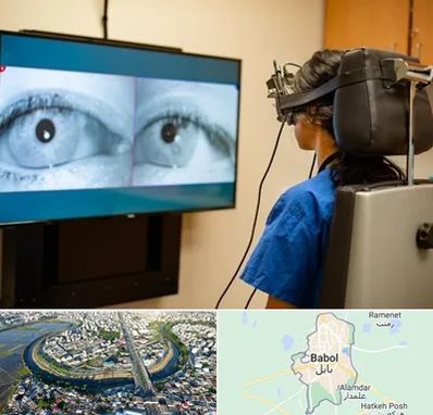 تست سرگیجه و تعادل در بابل