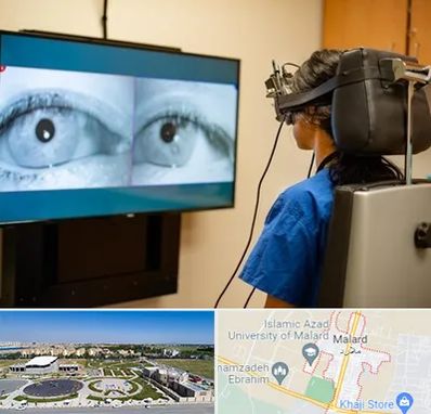 تست سرگیجه و تعادل در ملارد