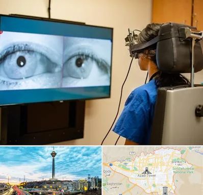 تست سرگیجه و تعادل در تهران