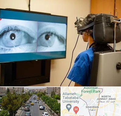 تست سرگیجه و تعادل در شهران 