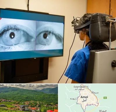 تست سرگیجه و تعادل در آمل