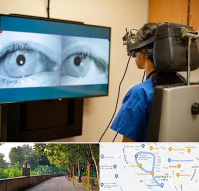 تست سرگیجه و تعادل در بلوار گیلان رشت 