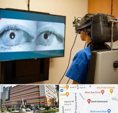 تست سرگیجه و تعادل در سهروردی 