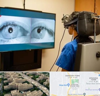 تست سرگیجه و تعادل در اکباتان 