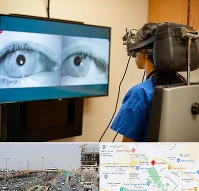 تست سرگیجه و تعادل در بلوار توس مشهد 