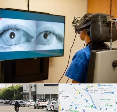 تست سرگیجه و تعادل در قدوسی شرقی شیراز