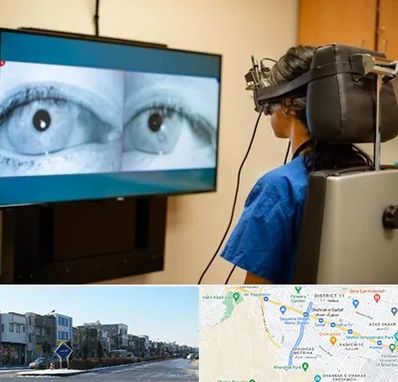 تست سرگیجه و تعادل در شریعتی مشهد 