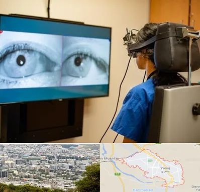 تست سرگیجه و تعادل در یاسوج