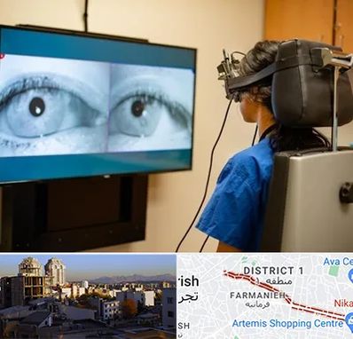 تست سرگیجه و تعادل در فرمانیه 