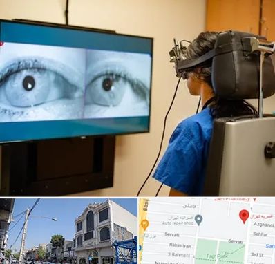 تست سرگیجه و تعادل در افسریه 