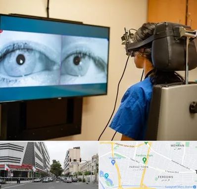 تست سرگیجه و تعادل در بلوار فردوس 