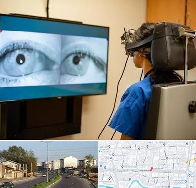 تست سرگیجه و تعادل در ضیابری رشت 