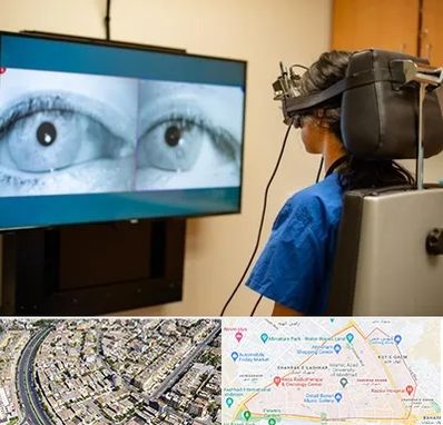 تست سرگیجه و تعادل در شهرک غرب مشهد 