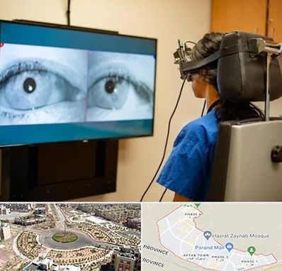 تست سرگیجه و تعادل در پرند