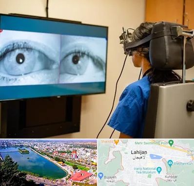 تست سرگیجه و تعادل در لاهیجان