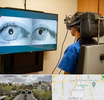 تست سرگیجه و تعادل در یوسف آباد 