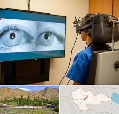 تست سرگیجه و تعادل در خاش