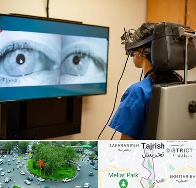 تست سرگیجه و تعادل در تجریش 