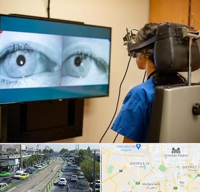 تست سرگیجه و تعادل در جنوب تهران 