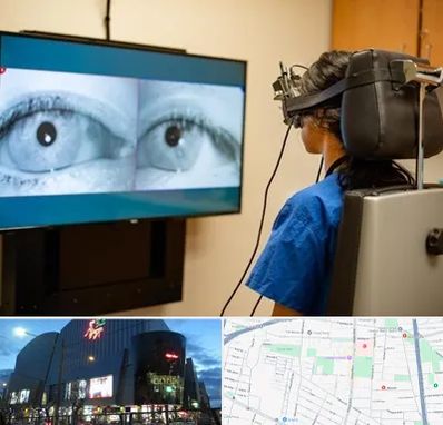 تست سرگیجه و تعادل در بلوار اباذر