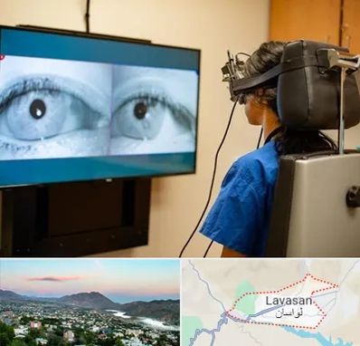 تست سرگیجه و تعادل در لواسان