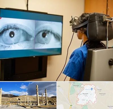 تست سرگیجه و تعادل در مرودشت