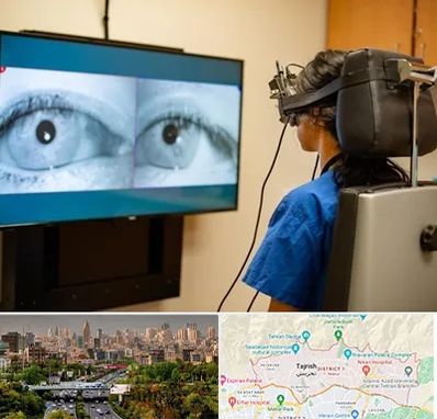 تست سرگیجه و تعادل در منطقه 1 تهران 