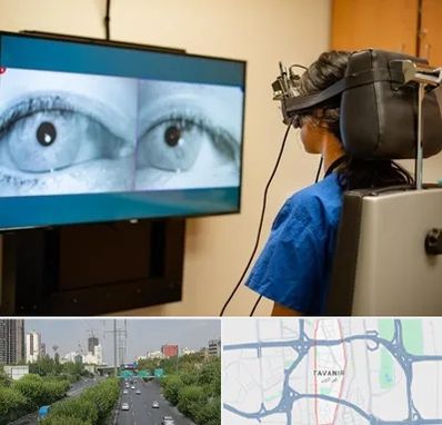 تست سرگیجه و تعادل در توانیر