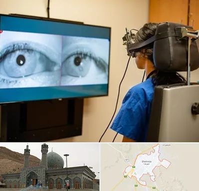 تست سرگیجه و تعادل در شهرضا