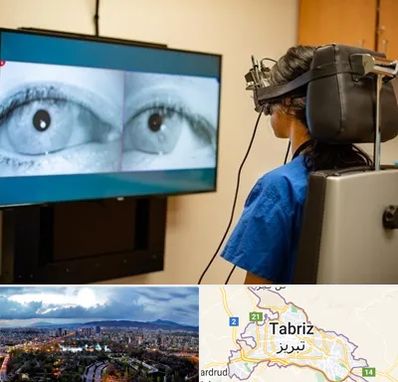 تست سرگیجه و تعادل در تبریز