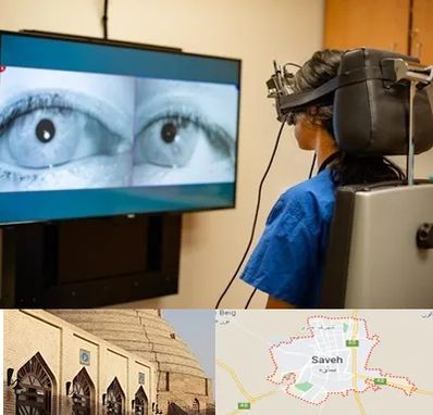 تست سرگیجه و تعادل در ساوه