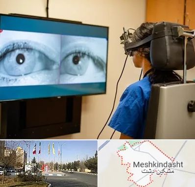 تست سرگیجه و تعادل در مشکین دشت