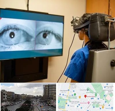 تست سرگیجه و تعادل در بلوار فردوسی مشهد 