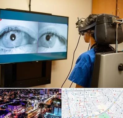 تست سرگیجه و تعادل در منظریه رشت 