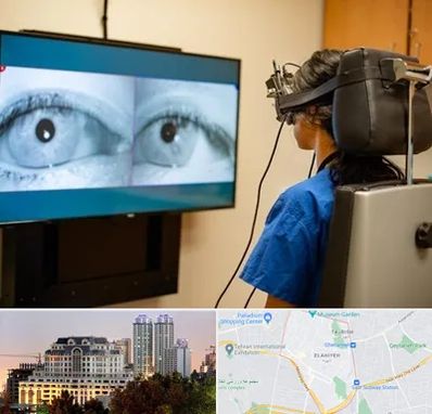 تست سرگیجه و تعادل در فرشته 