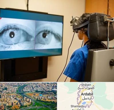 تست سرگیجه و تعادل در اردبیل