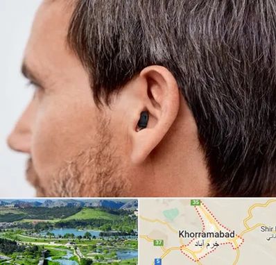 سمعک نامرئی در خرم آباد