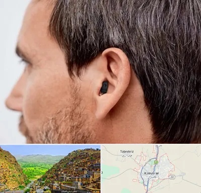 سمعک نامرئی در کامیاران